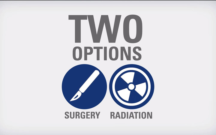 Opciones de tratamiento del cáncer de próstata